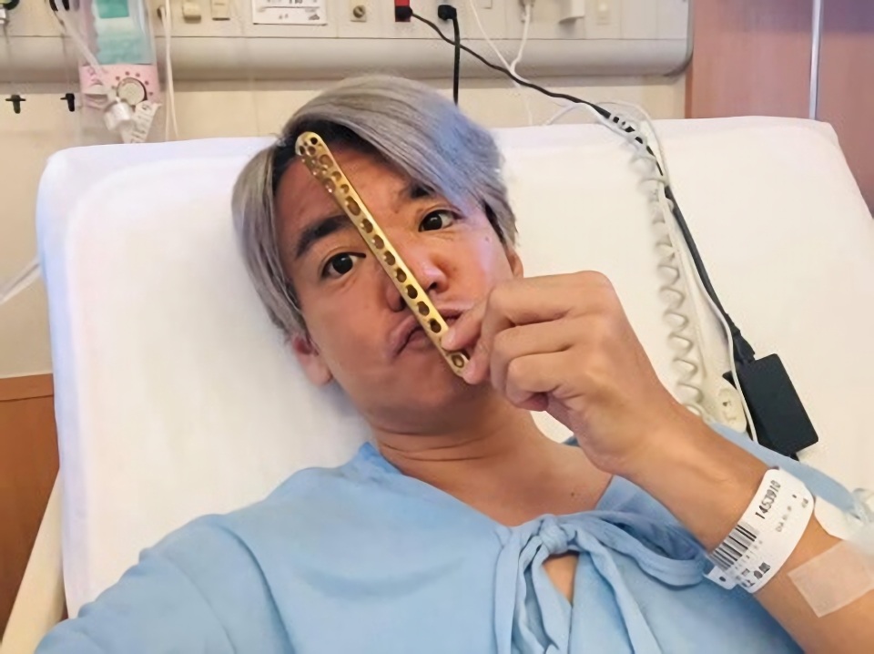 右脛骨の複雑骨折で術後のサンクスラボ代表村上